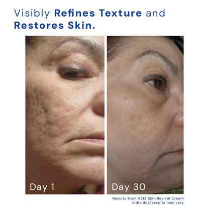 Retinol Skin Revival Cream